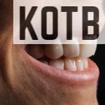 rejuvenecimiento dental