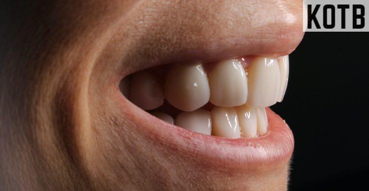 rejuvenecimiento dental