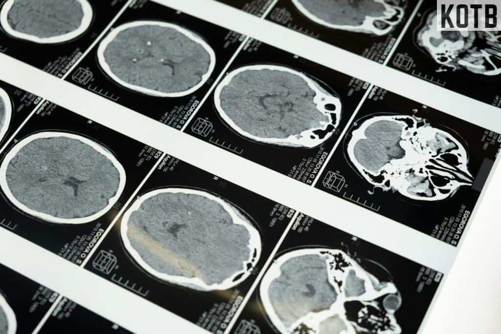 MRI Images of the Brain